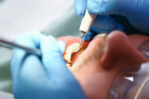 Best Emergency Tooth Extraction in Franklin Park, NJ
