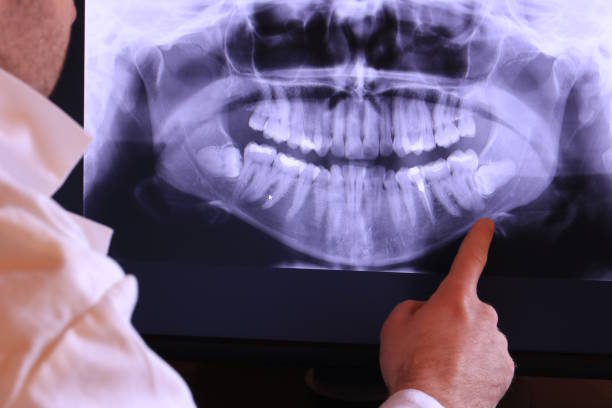 Best Emergency Tooth Extraction in Franklin Park, NJ