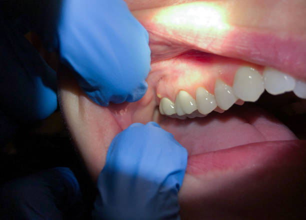 Best Emergency Broken Tooth Repair in Franklin Park, NJ